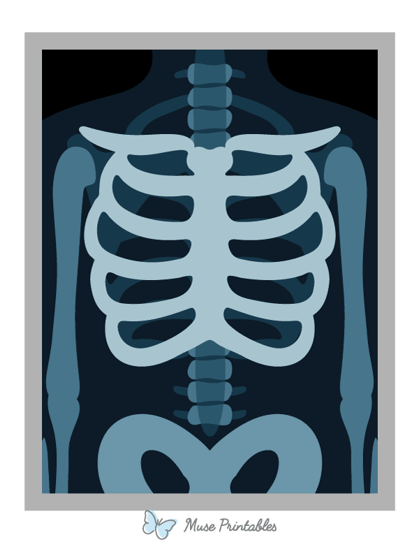 X-ray Photo Booth Prop
