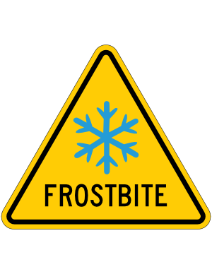 Frostbite Sign